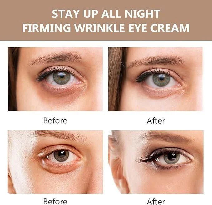 Instant FIRMx Eye Tightener & Eye Care Cream (Buy 1 Get 1 Free🔥)