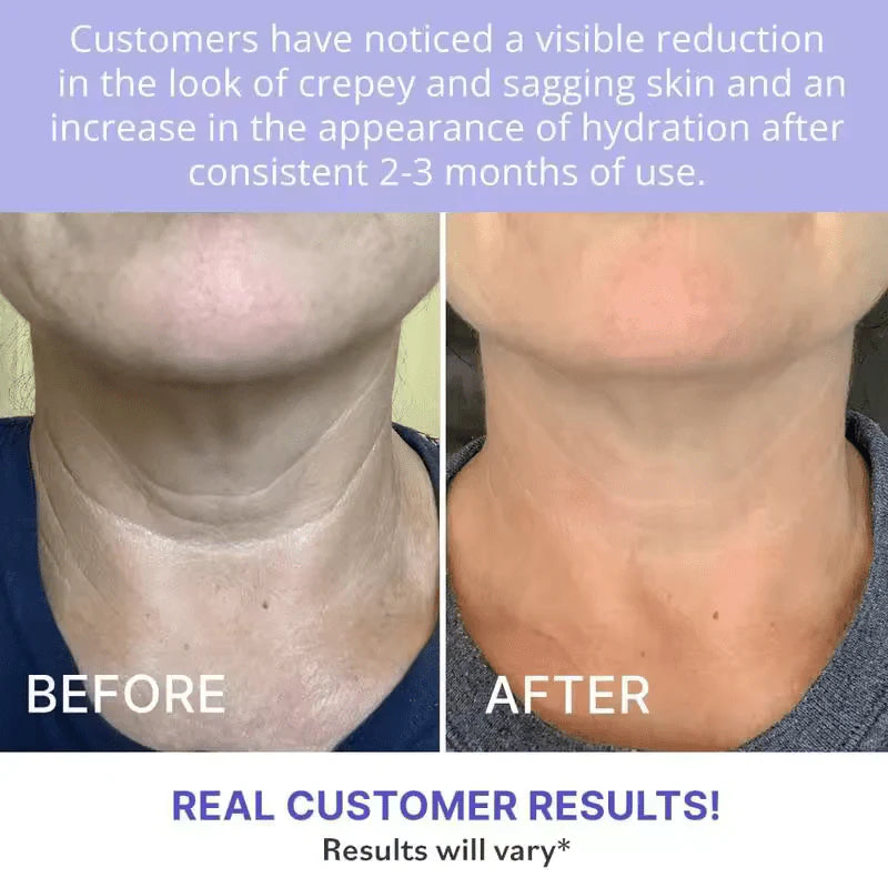 Tighten & Lift Neck Cream For Men & Women (Buy 1 get 1 Free🔥)