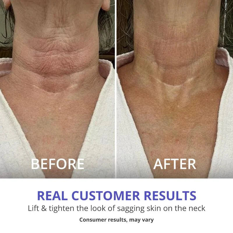 Tighten & Lift Neck Cream For Men & Women (Buy 1 get 1 Free🔥)